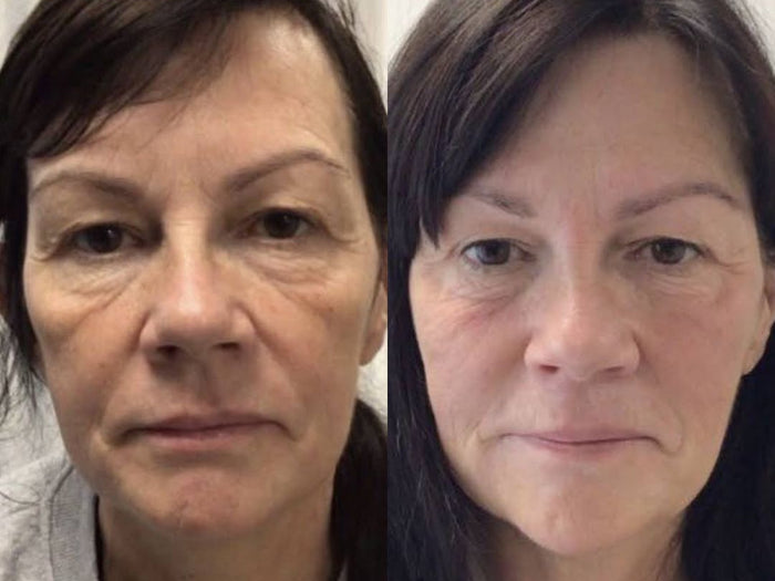 Tired-Looking Skin